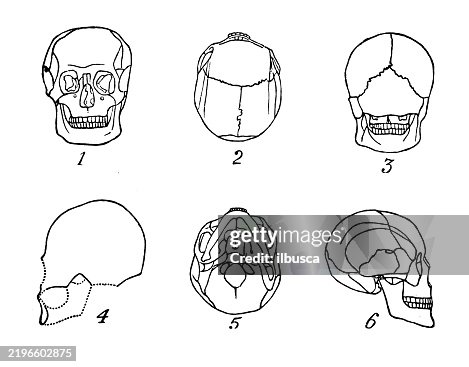 Cranium Cranium