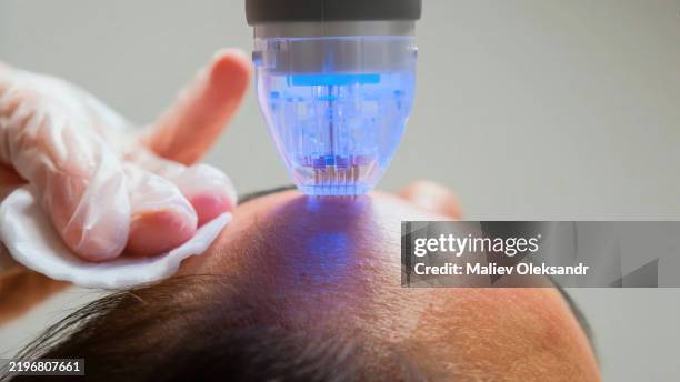Seasonal Trends in Medical Aesthetic Devices: What to Expect