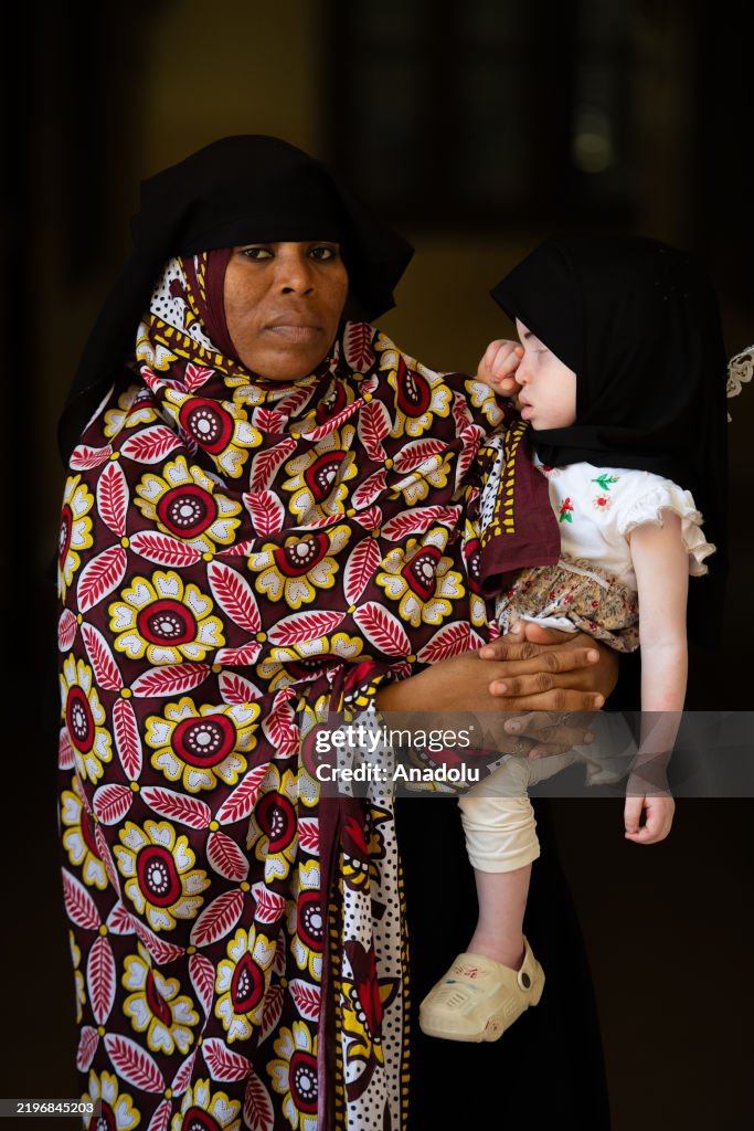 Albino children in Zanzibar