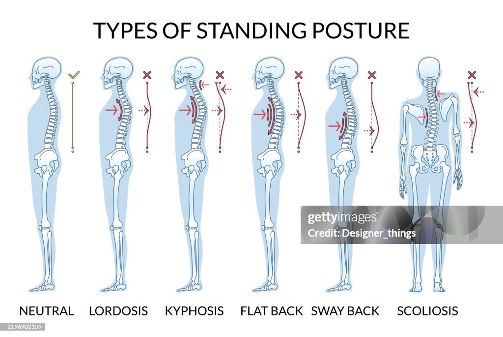 Understanding The Different Types Of Standing Posture For Achieving ...