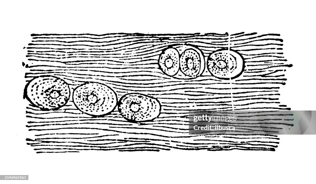 Fibrocartilage, section of intervertebral disk