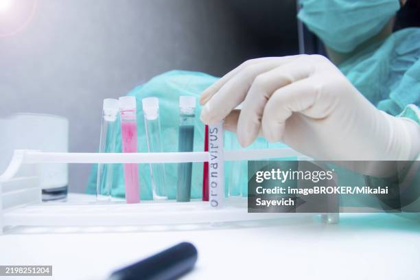 a hand arranging a coronavirus test tube in a rack with other colorful tubes under bright lab lighting - lateral flow test stock pictures, royalty-free photos & images