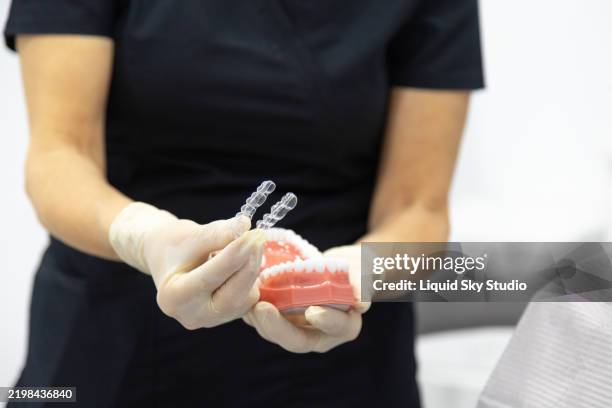 dental professional demonstrating orthodontic tools - aparelho dentário imagens e fotografias de stock