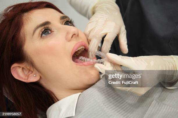 dentist applying invisible braces to a young woman patient - cosmetic dentistry stock pictures, royalty-free photos & images