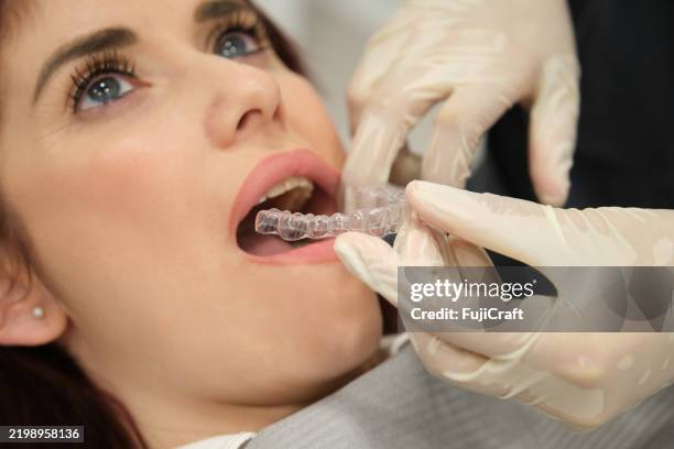 dentist placing invisible braces aligner in young woman's mouth - cuidados de saúde primários imagens e fotografias de stock