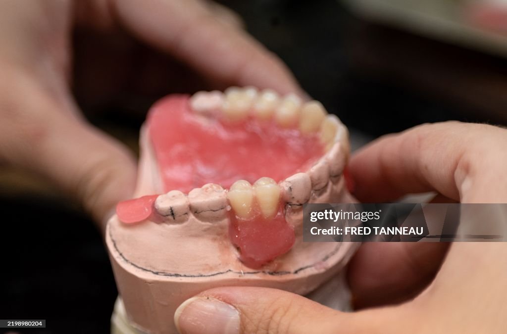 FRANCE-HEALTH-DENTISTRY
