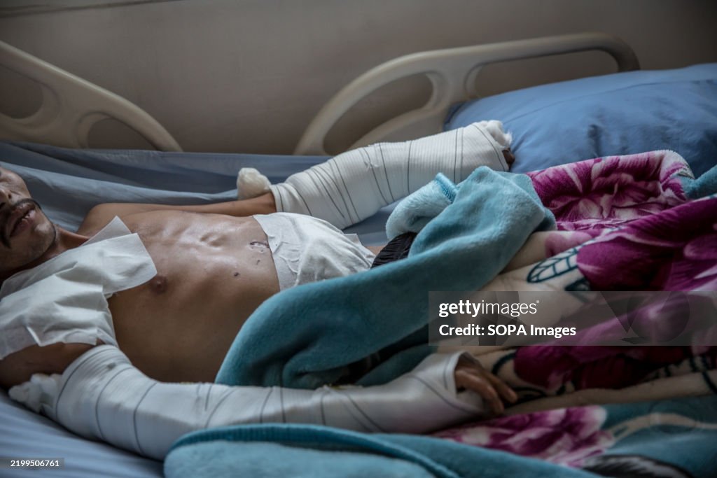 A "border guard" recovers from an injury caused by a Turkish...