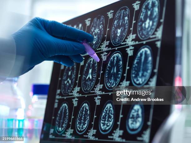 dementia and alzhiemer's research, scientist preparing human sample during a clinical trial - medical scan stock pictures, royalty-free photos & images