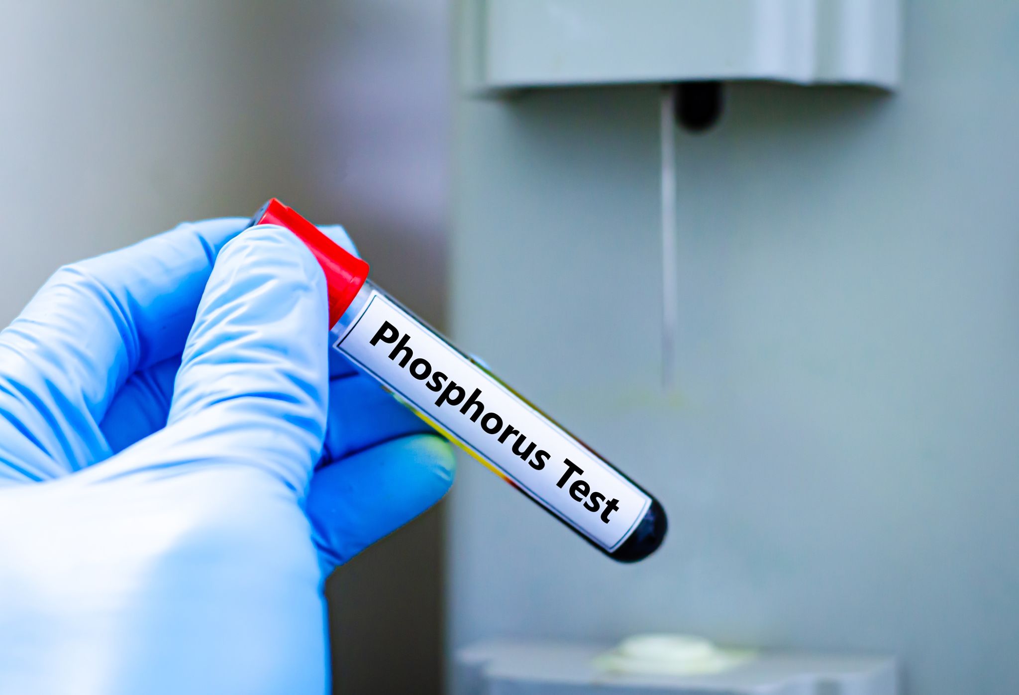 phosphorus fertilizer