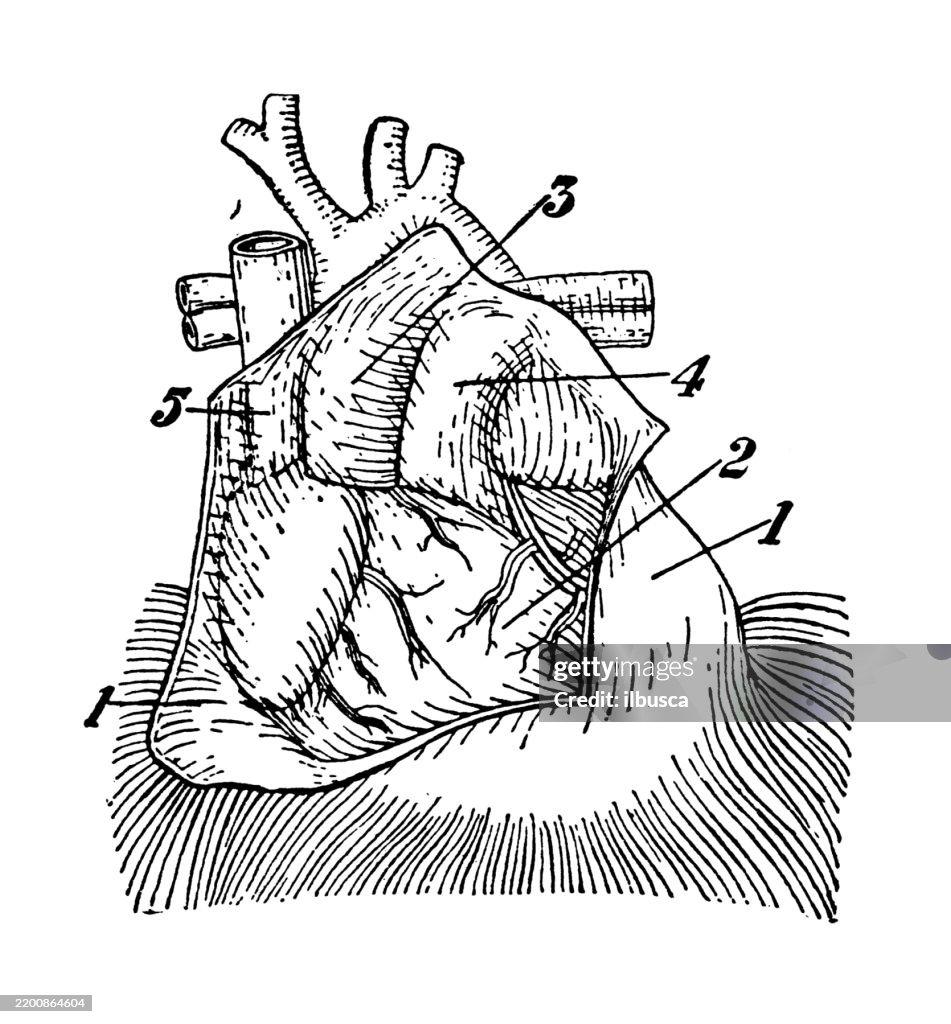 Anterior view of heart, Pericardium