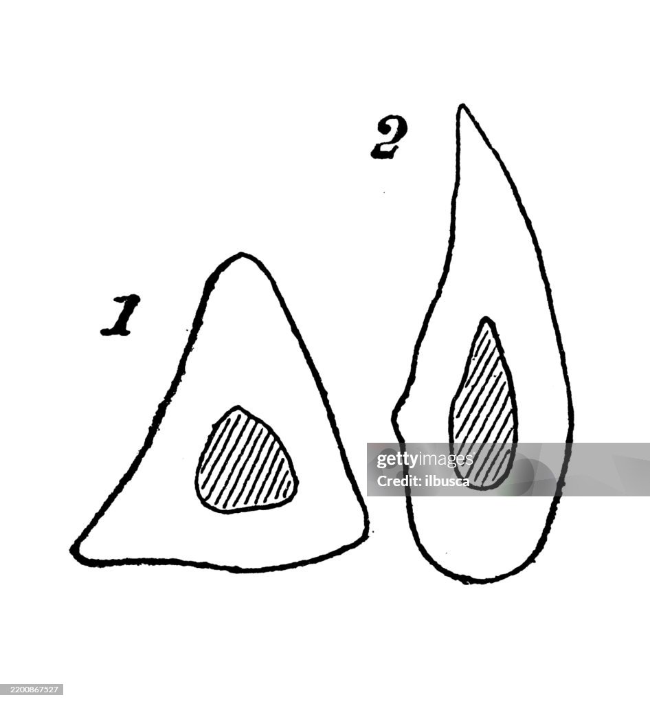 Tibial Normal Development Human Tibia Section Normal And Platycnemic High-Res Vector Graphic ...