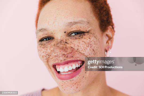 ritratto ravvicinato di una giovane donna lentigginosa con sorriso a denti stretti - lentiggine foto e immagini stock