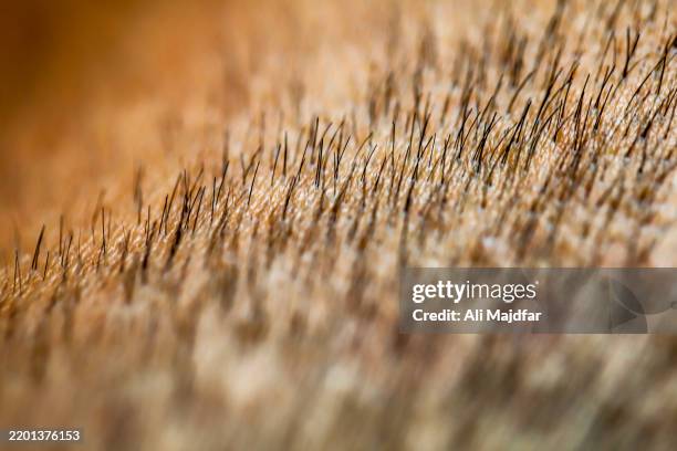 scalp hair transplant - stoppelbart stock-fotos und bilder