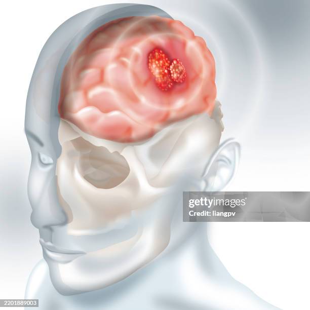 brain cancer - command center stock illustrations