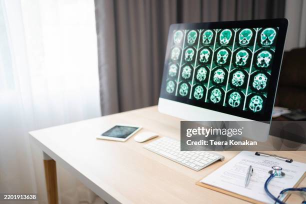 ct scan of the human brain, medical treatment concepts, and diagnosis of diseases in the human head. - cat scan stock pictures, royalty-free photos & images