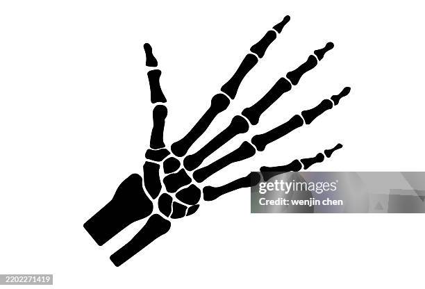 symbol für die orthopädie des handgelenks - skelett hand stock-grafiken, -clipart, -cartoons und -symbole