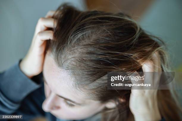 gran concepto de alergia y enfermedades de piel - cuero cabelludo fotografías e imágenes de stock