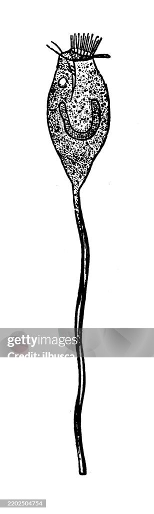 Vorticella