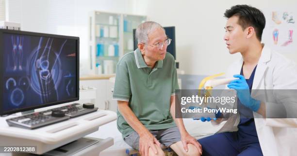 asian elderly knee health consult - bindegewebe stock-fotos und bilder