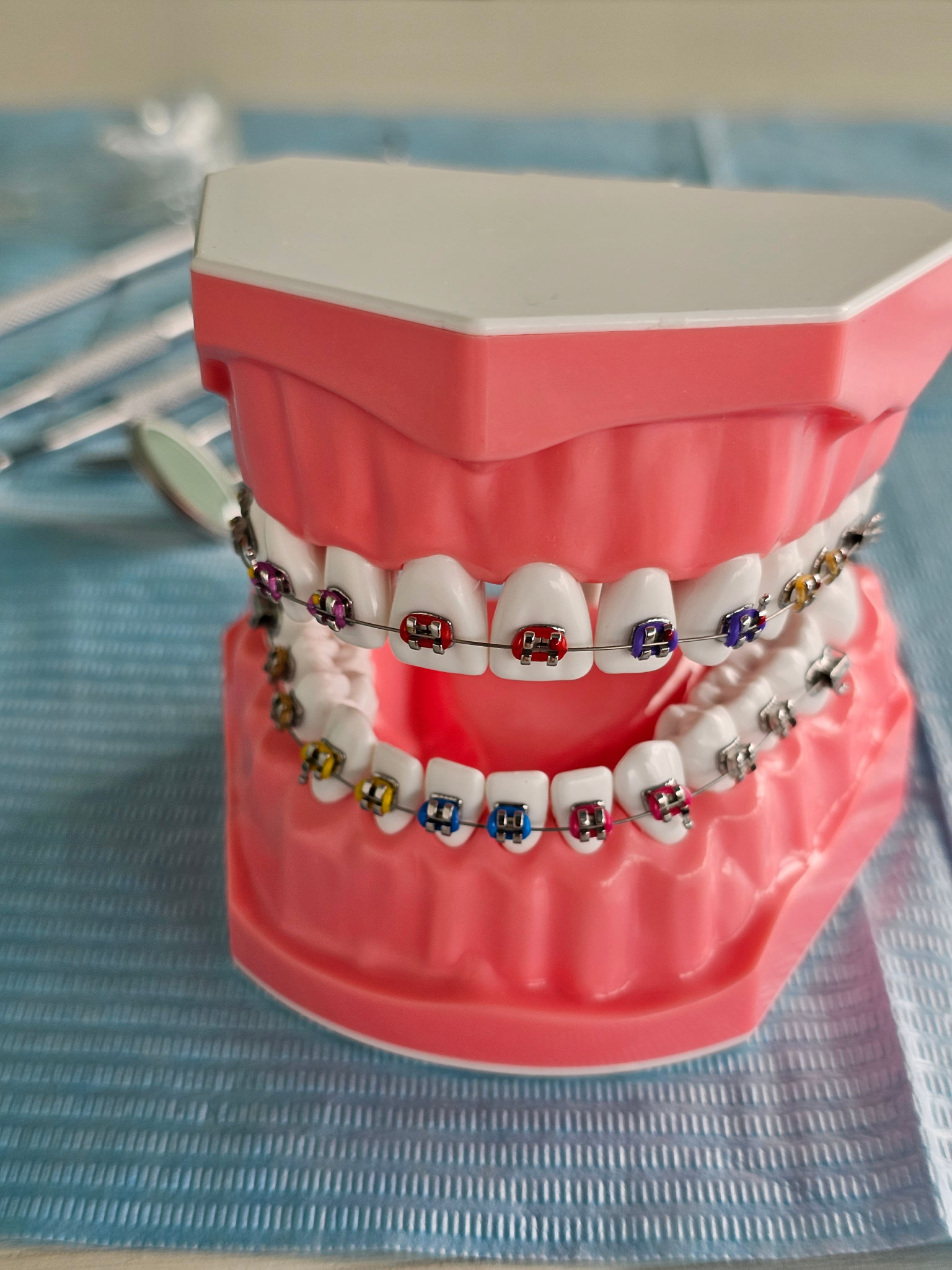 types of dental veneers