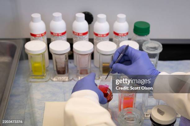 Rita Roberts does research on skin wound healing in a lab in the Department of Kinesiology and Nutrition at the University of Illinois Chicago on...