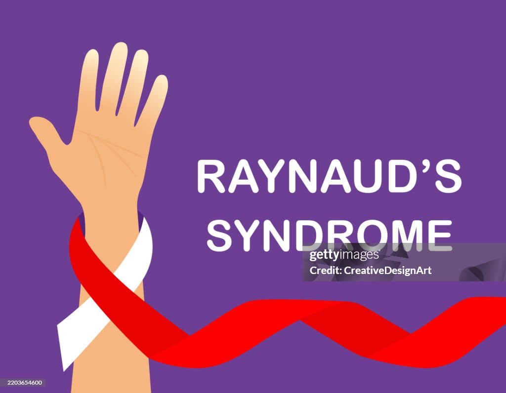 Raynaud's Syndrome Awareness Concept. Hand With Raynaud’s Disease On Purple Background