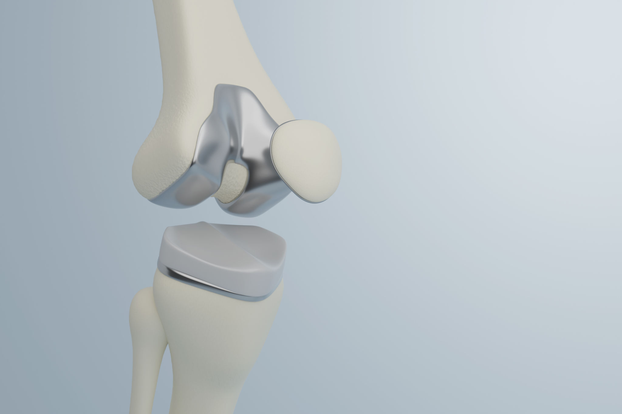 joint replacement