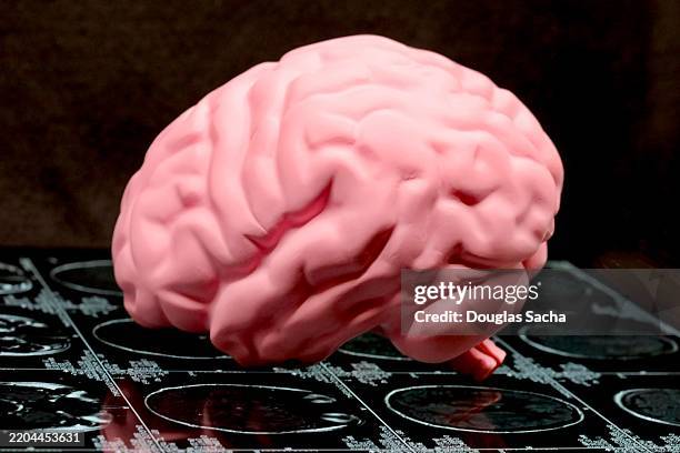 Cte Brain Model 229 Cte Brain Stock Photos, High-Res Pictures, and Images - Getty Images