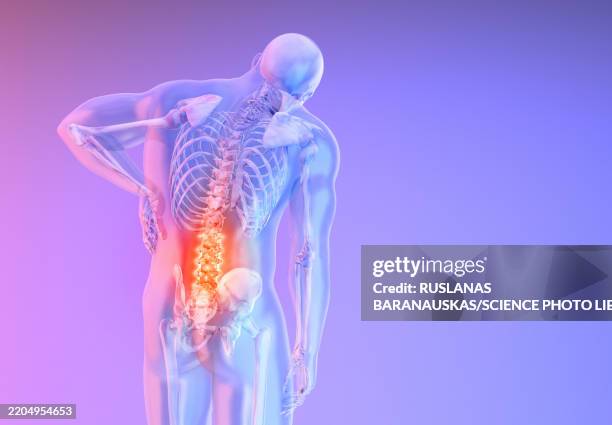 lower back pain, conceptual illustration - schmerz stock-grafiken, -clipart, -cartoons und -symbole