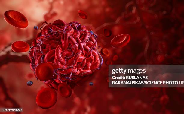 bildbanksillustrationer, clip art samt tecknat material och ikoner med blood clot, illustration - blodpropp