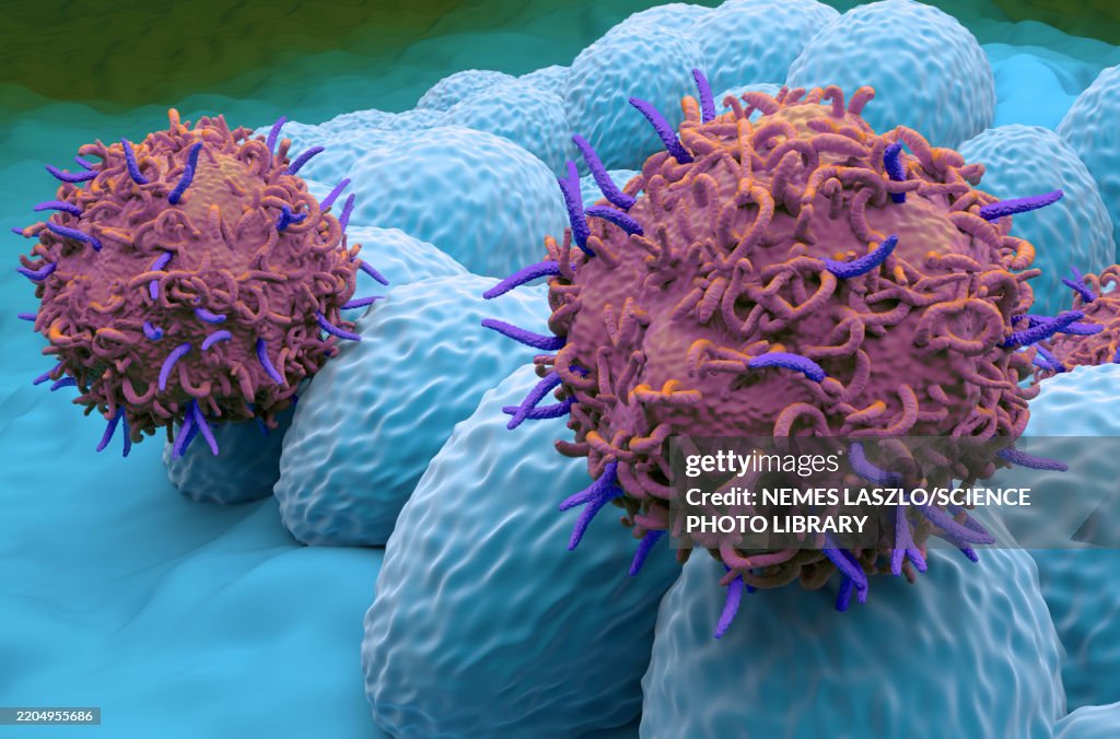CAR-T cell therapy for endometrial cancer, illustration