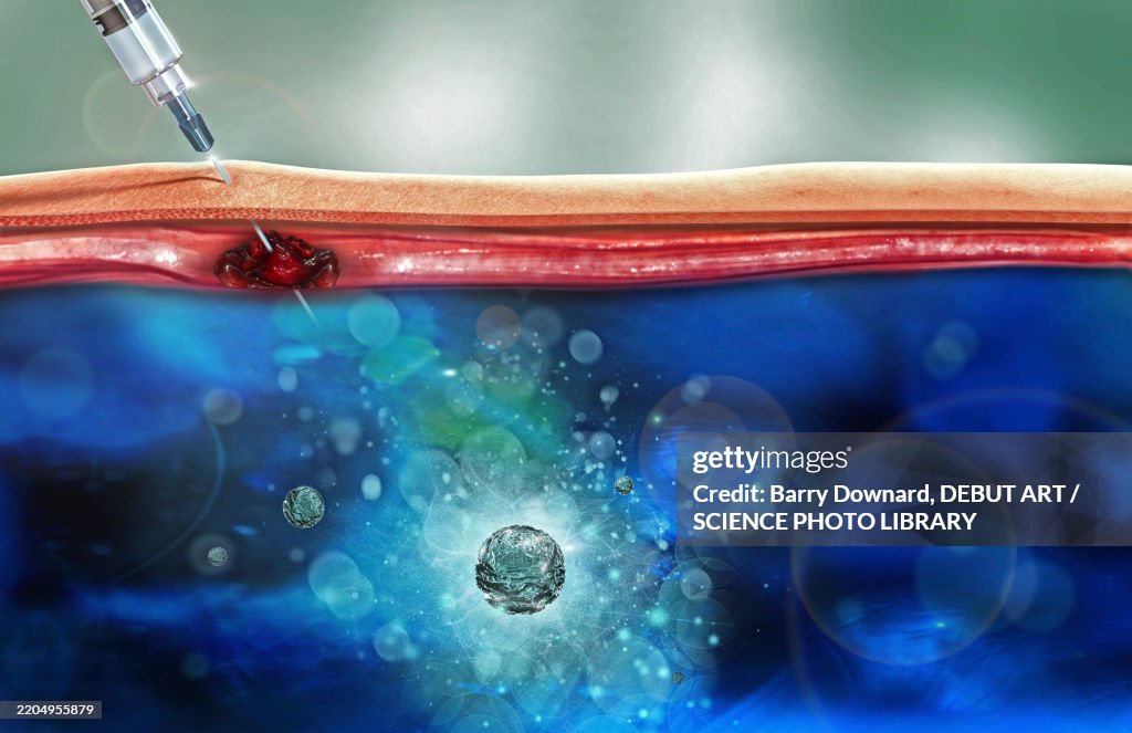 Injection, illustration