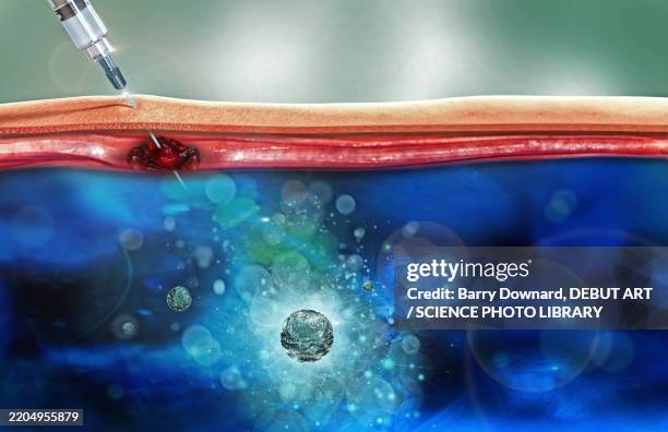 injection, illustration - subcutaneous stock illustrations