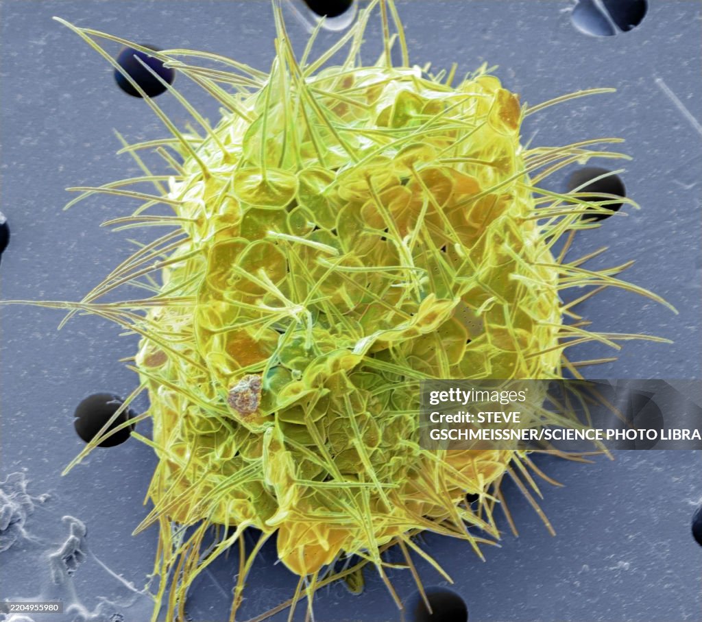 Acanthocystis, SEM