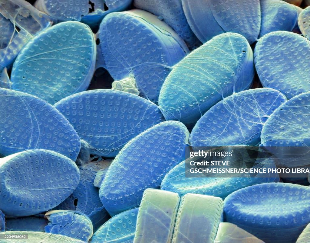 Diatoms, SEM