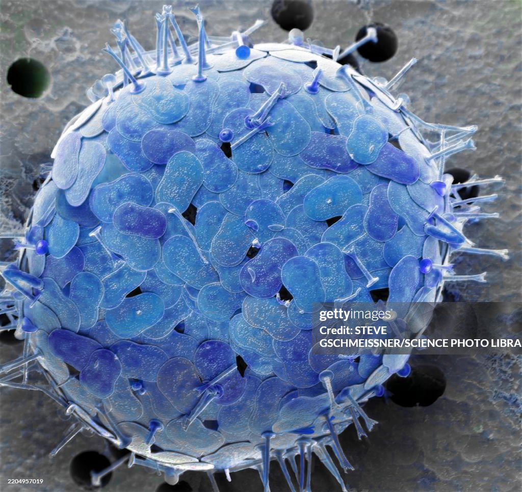 Acanthocystis, SEM