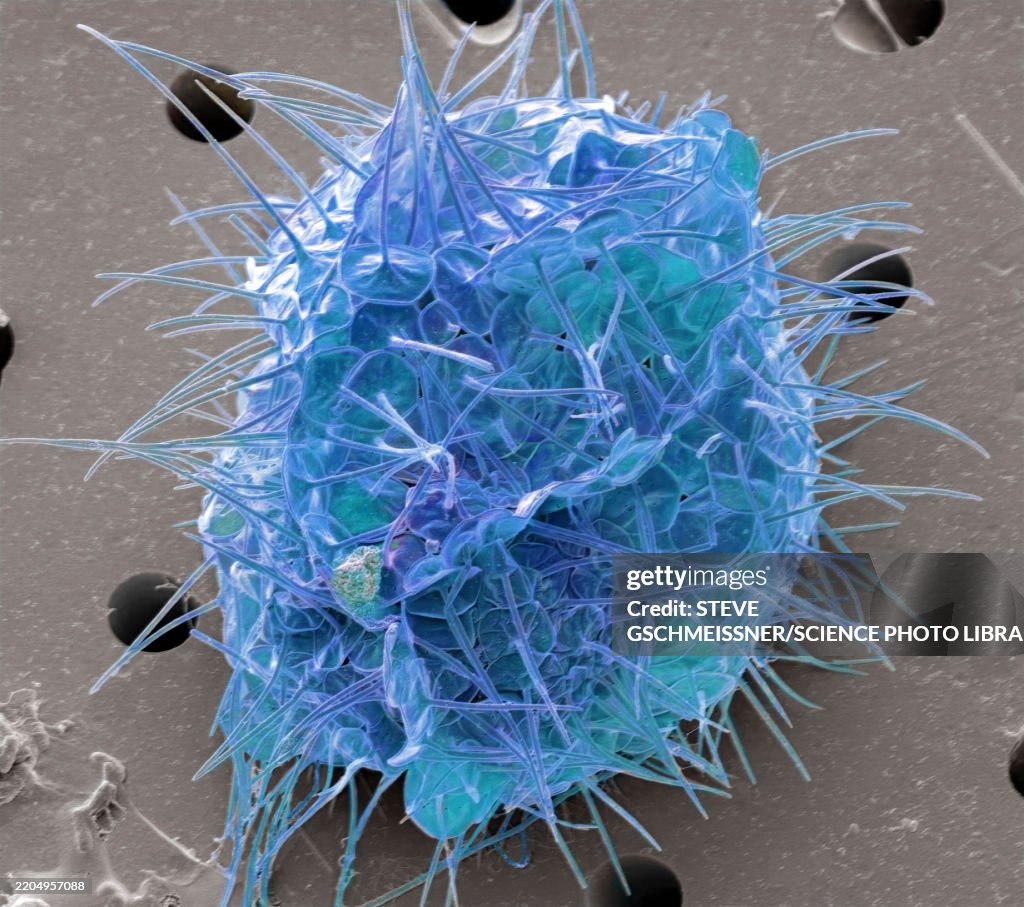 Acanthocystis, SEM