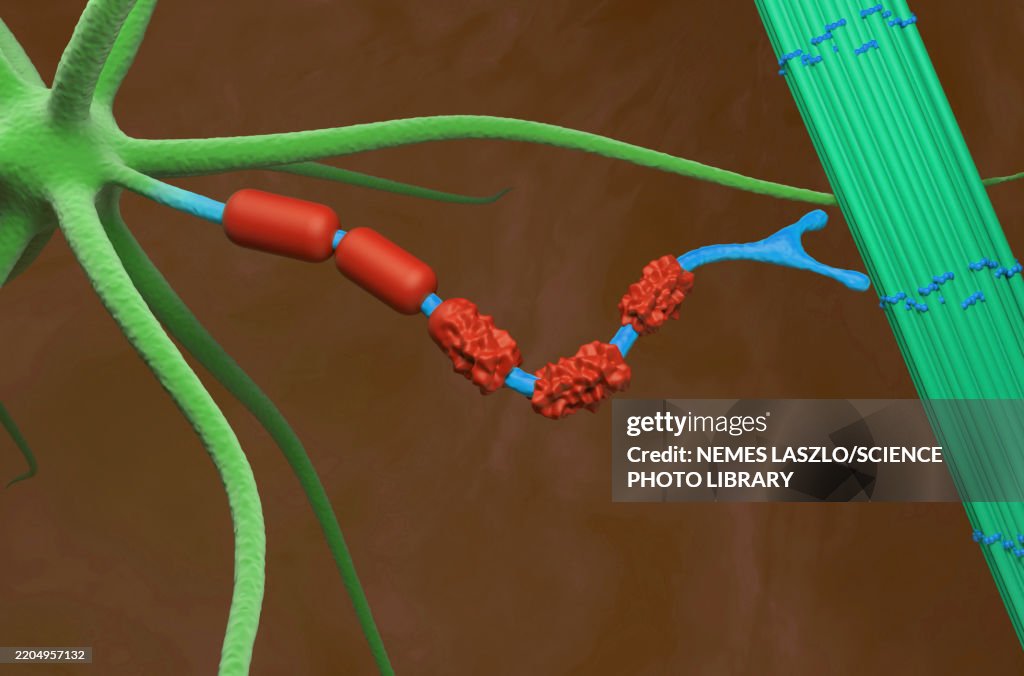 Neuromuscular junction in amyotrophic lateral sclerosis, illustration