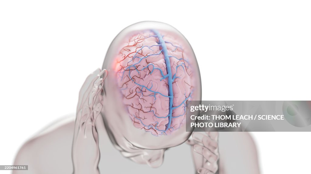 Brain Condition Brain Condition Conceptual Illustration High-Res Vector Graphic - Getty ...