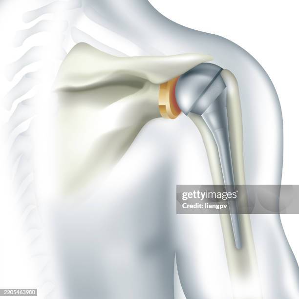 ilustrações, clipart, desenhos animados e ícones de substituição do ombro - tecido humano termo anatômico