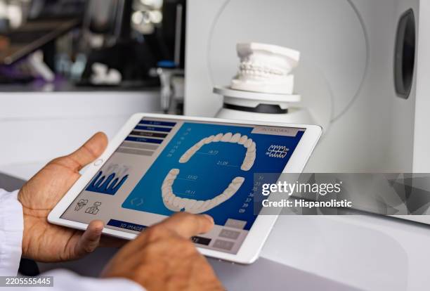 dentist making a 3d dental mold using a digital tablet - implante imagens e fotografias de stock
