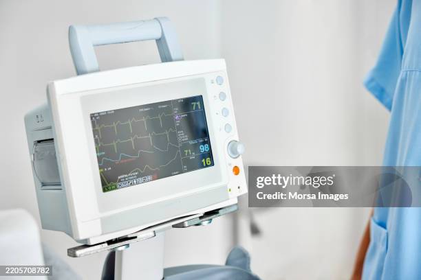 monitoring equipment in operating room - hartmonitor stockfoto's en -beelden