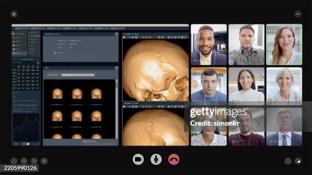 medical video conference with 3d skull scan analysis - character animation stock pictures, royalty-free photos & images