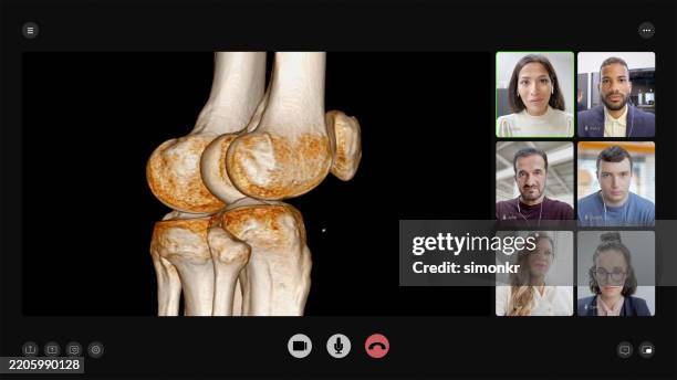 medical video conference with 3d joint scan analysis - animation character stock pictures, royalty-free photos & images