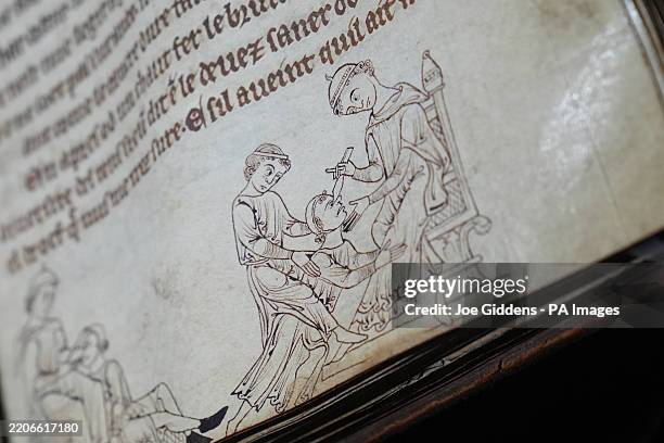Illustrations in a 13th century manuscript describing a cauterization treatment for nasal polyps, on display during the press preview of Curious...