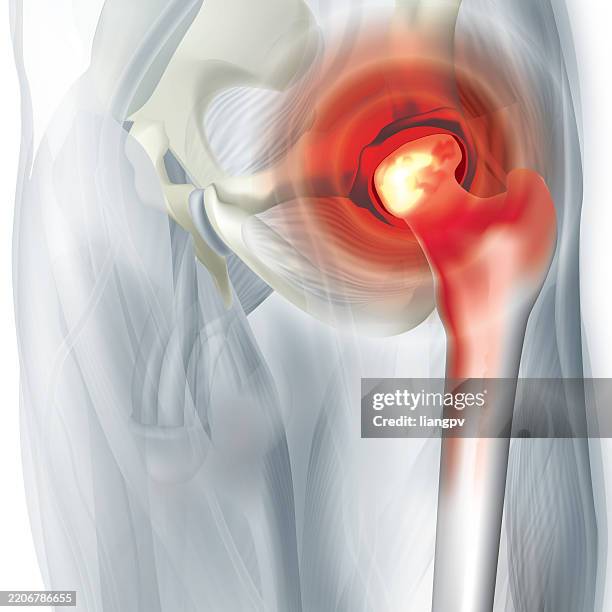 hip pain - hip body part stock illustrations