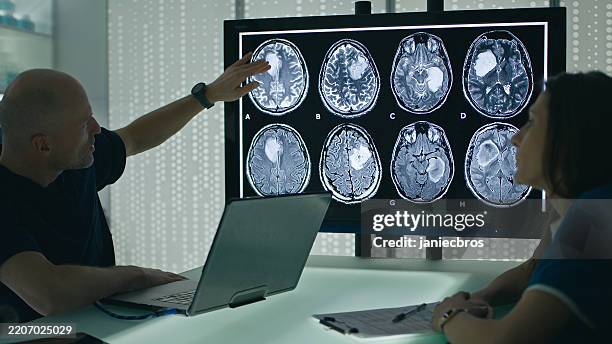 ärzte diskutieren eeg-untersuchung am gehirn des patienten in medizinischer einrichtung - eeg stock-fotos und bilder