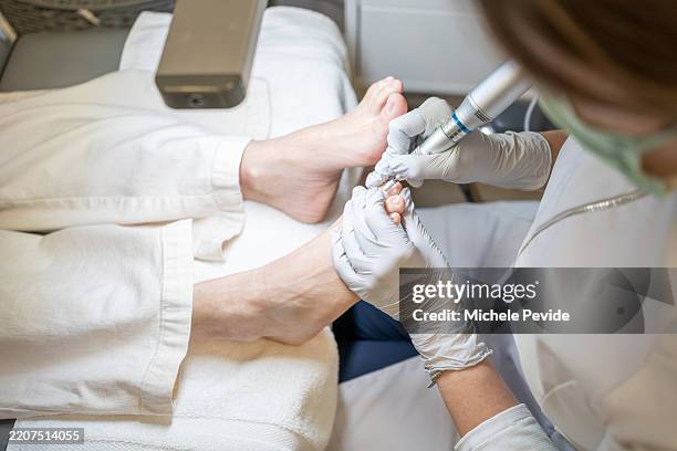podologo che esegue un trattamento in un paziente - pedicure foto e immagini stock