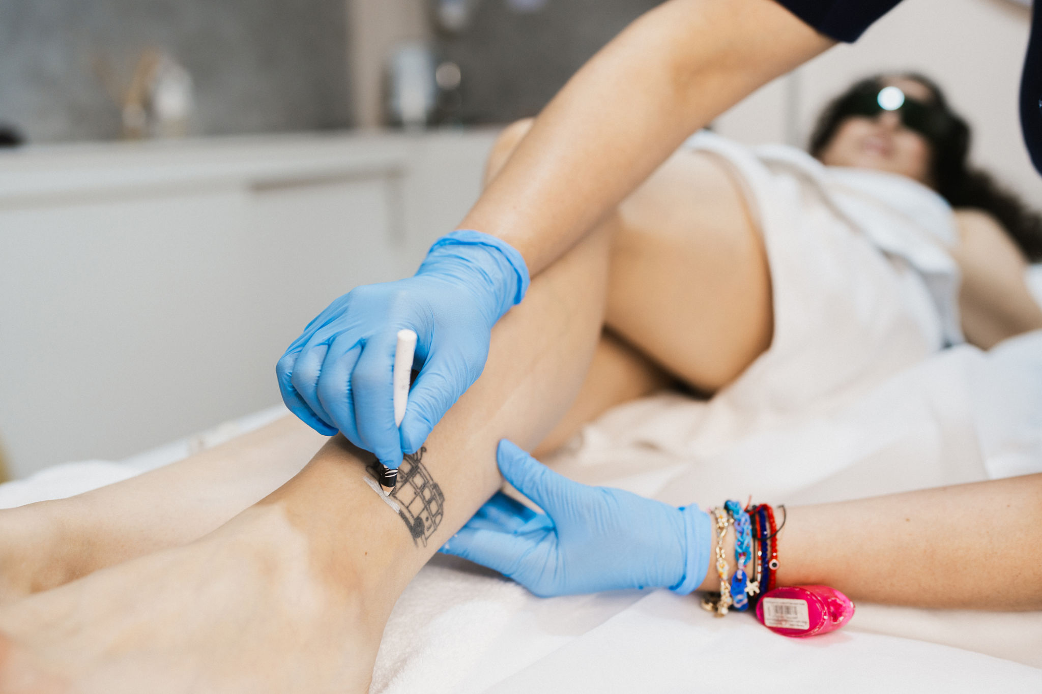 tattoo removal cream