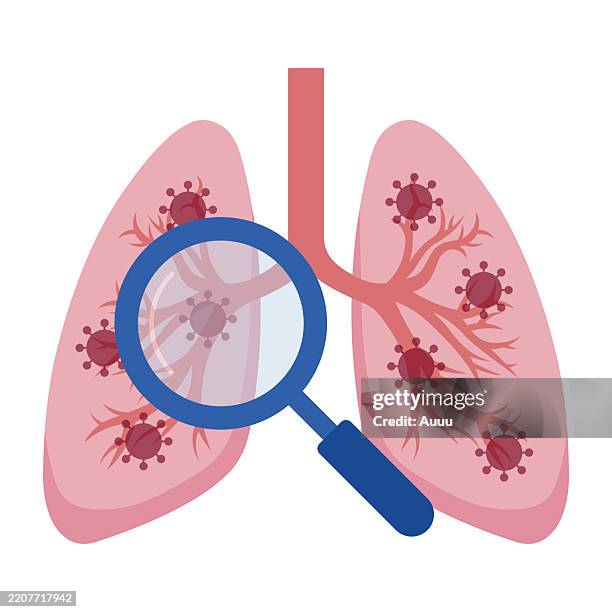 stockillustraties, clipart, cartoons en iconen met international union against tuberculosis and lung disease - menselijke long